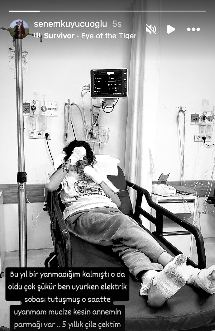 Senem Kuyucuoğlu kimdir, kaç yaşında? Eski manken yaşadığı yangın faciasını duyurdu! - 1. Resim