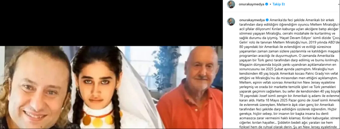 ABD'de yaşayan Meltem Miraloğlu hakkında şok iddia: Darbedildi, kırılan kaburgaları akciğerine battı ABD'de yaşayan Meltem Miraloğlu hakkında şok iddia: Darp edildi, kırılan kaburgaları akciğerine battı - 4. Resim