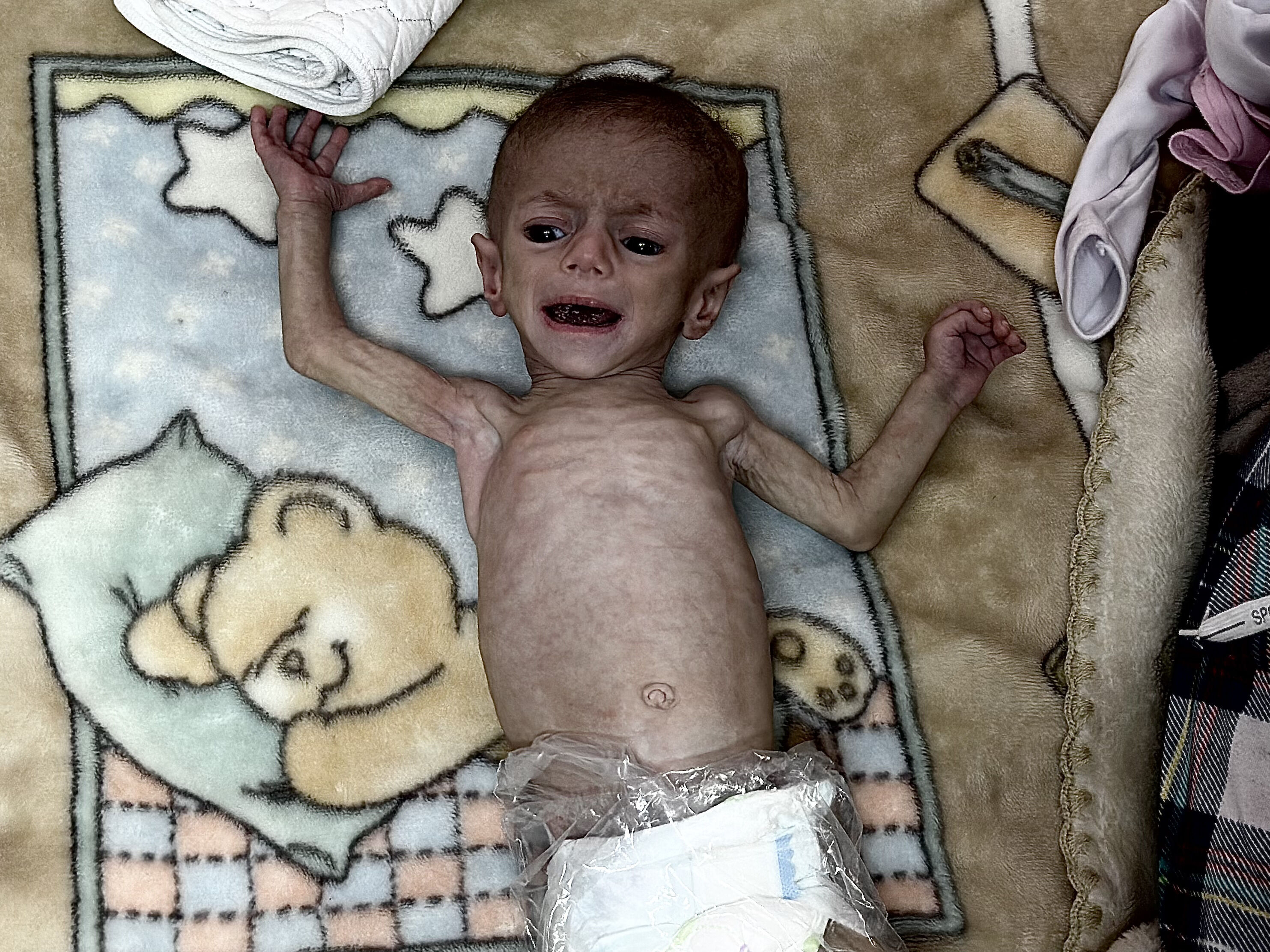 Yavrusu açlıktan ölen Gazzeli anne: Bütün dünyaya yazıklar olsun - 1. Resim