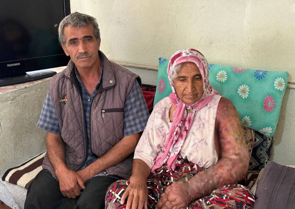 B&ouml;ylesi g&ouml;r&uuml;lmedi! Kolundan v&uuml;cuduna uzandı: 4 &ccedil;ocuk annesi kabusu yaşıyor - 1. Resim