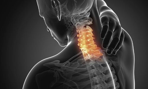 Teknoloji çağının yaygın rahatsızlığı: Boyun düzleşmesi neden olur, nasıl tedavi edilir? Teknoloji çağının yaygın rahatsızlığı: Boyun düzleşmesi neden olur, nasıl tedavi edilir? - 7. Resim