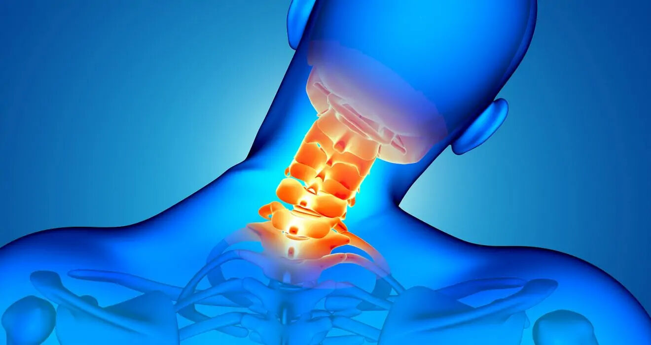 Teknoloji çağının yaygın rahatsızlığı: Boyun düzleşmesi neden olur, nasıl tedavi edilir? Teknoloji çağının yaygın rahatsızlığı: Boyun düzleşmesi neden olur, nasıl tedavi edilir? - 4. Resim