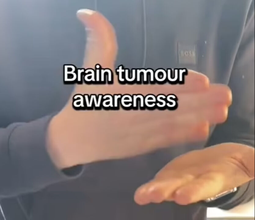 Bu hareketleri yapamayanlar dikkat! 30 saniyelik test hayatınızı değiştirebilir Bu hareketleri yapamayanlar dikkat! 30 saniyelik test hayatınızı değiştirebilir - 1. Resim