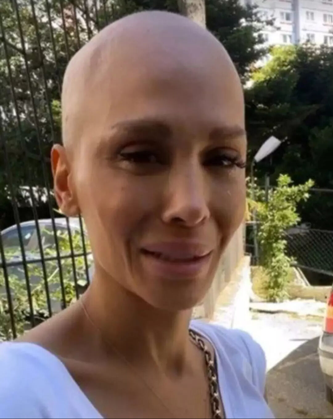 Kanseri yenen ünlü şarkıcı Şimal'den kötü haber geldi! Eşi o sözlerle duyurdu Kanseri yenen ünlü şarkıcı Şimal'den kötü haber geldi! Eşi o sözlerle duyurdu - 3. Resim