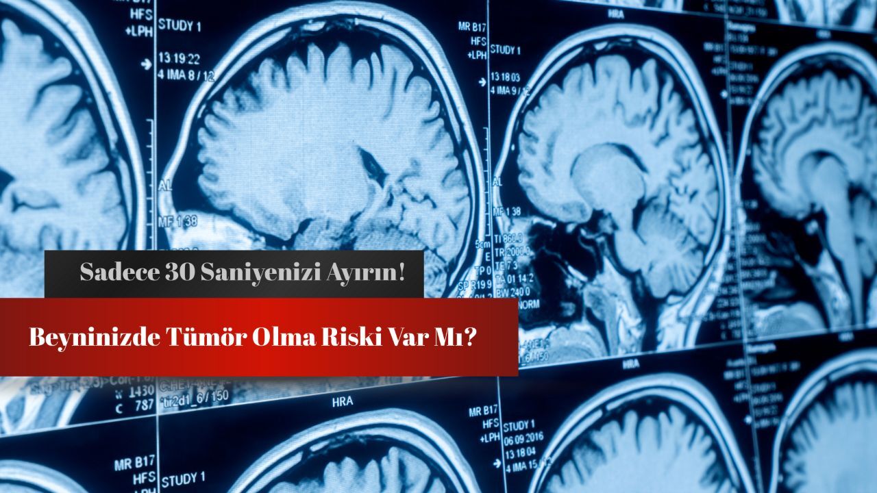 Beyin tümörü testi: Sadece 30 saniyenizi ayırın! Beyin tümörü testi: Sadece 30 saniyenizi ayırın!