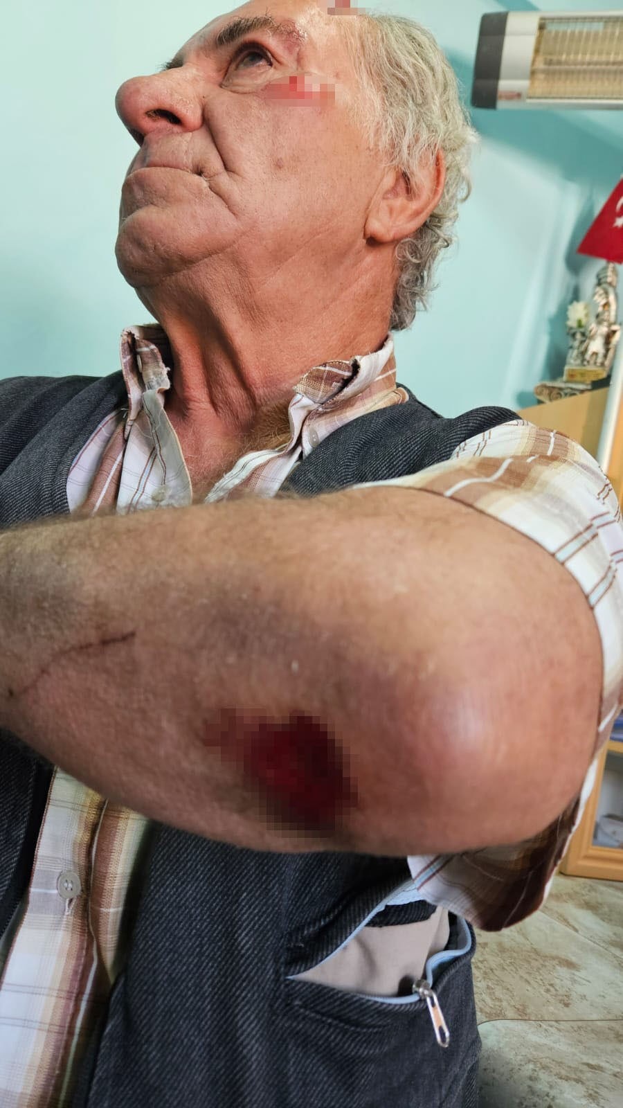 Salda'da korkunç saldırı! Başıboş köpeklerden kurtulmaya çalışan yaşlı adam içler acısı halde bulundu Salda'da korkunç saldırı! Başıboş köpeklerin parçaladığı yaşlı adam yol kenarında içler acısı halde bulundu - 3. Resim