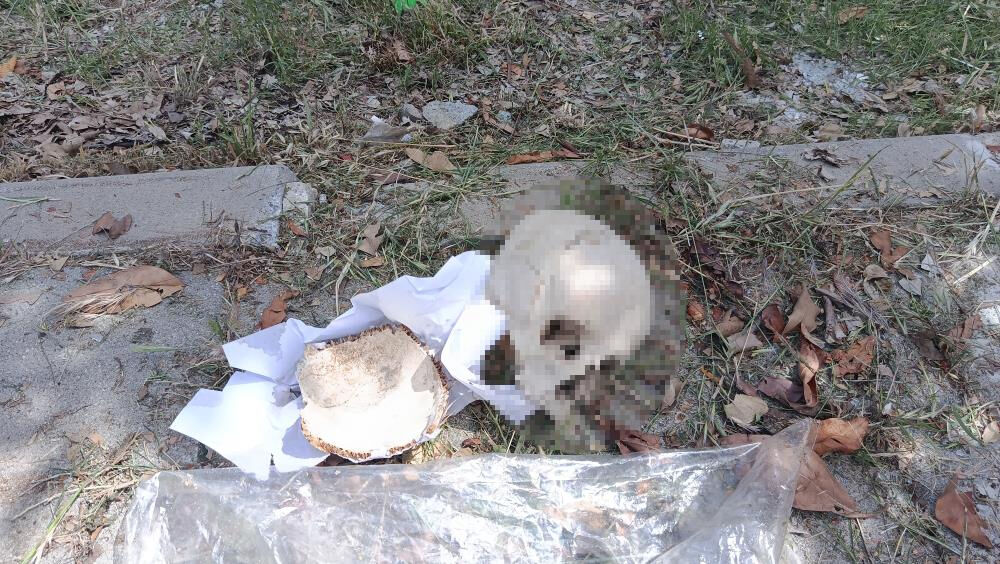 Adana'da korkunç olay! Çöp konteynerinden kafatası çıktı - 1. Resim