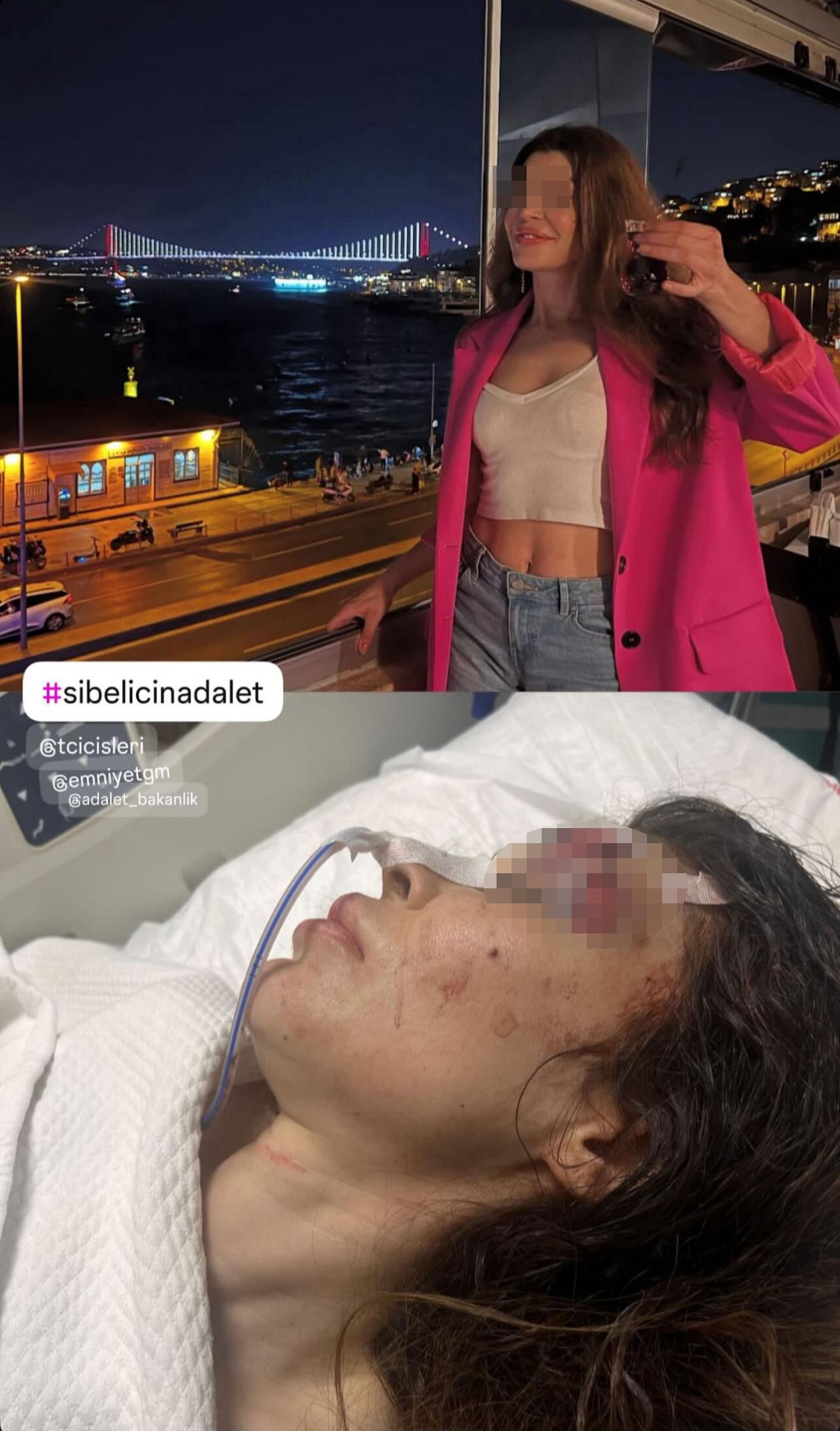 İş görüşmesine giden kadın dehşeti yaşadı! Boks hocasından bıçaklı ve yumruklu saldırı - 1. Resim