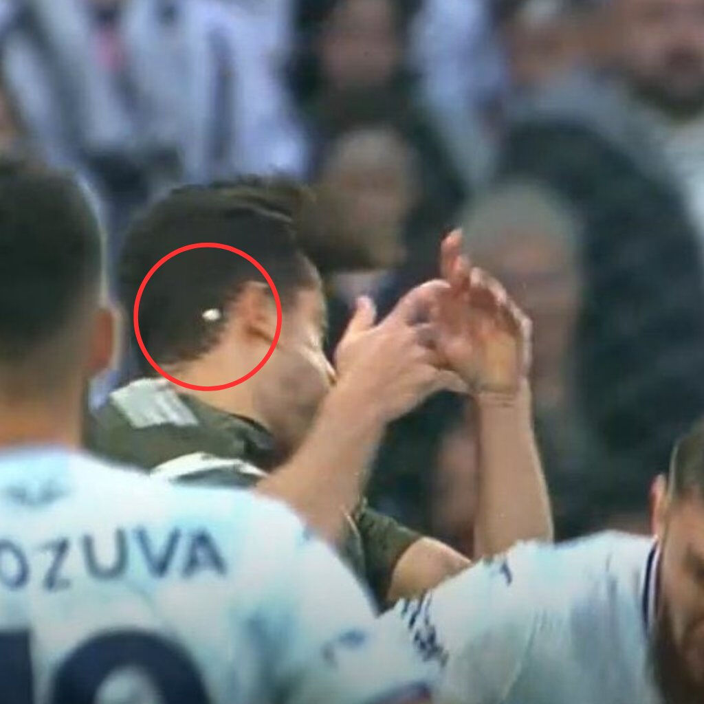 Beşiktaş üst üste sakatlıklarla sarsıldı! Yıldız oyuncunun dişi kırıldı, havada süzüldü - 3. Resim