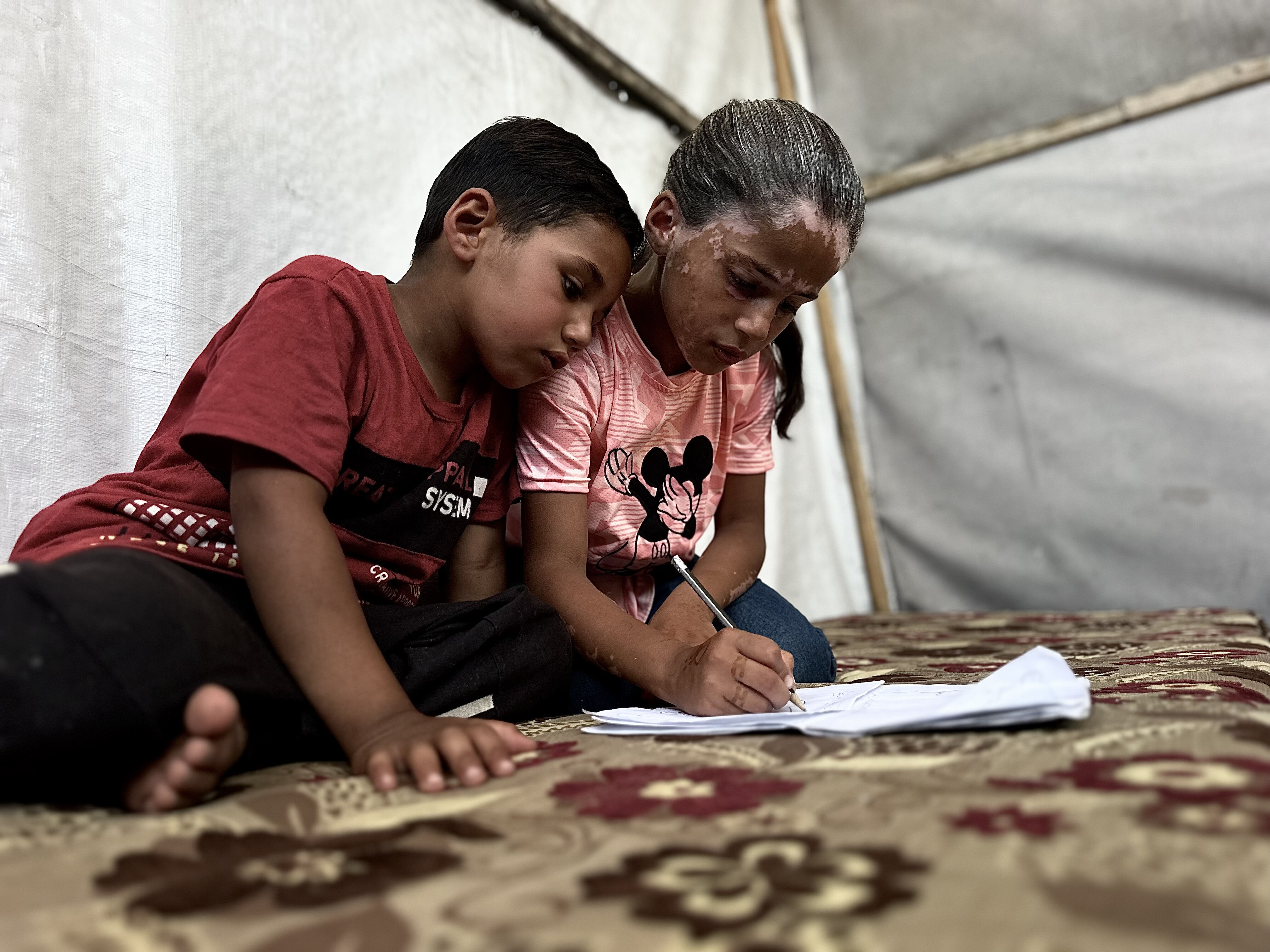 Yanı başına bombalar yağdı, korkudan hastalığa yakalandı! Gazzeli Lana yürek dağladı: Savaştan önce çok güzeldim - 4. Resim