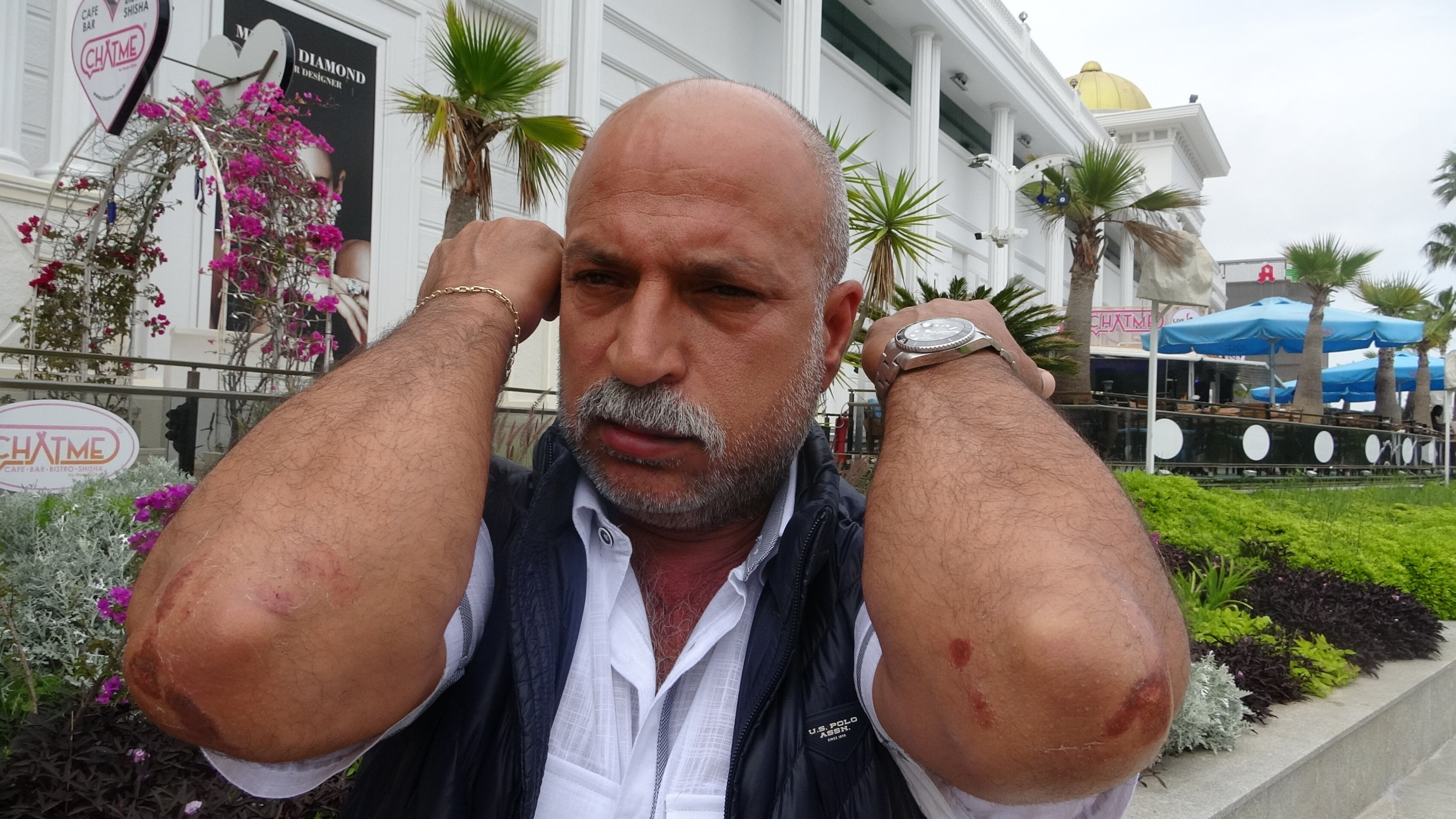 ''Husumetlinin selamı var'' diyerek sokak ortasında tekme tokat darbettiler - 1. Resim