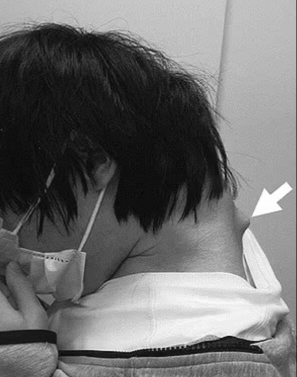 Uzun süre ekrana maruz kalanlar dikkat! Omurları yerinden oynadı, aylarca kabusu yaşadı - 1. Resim