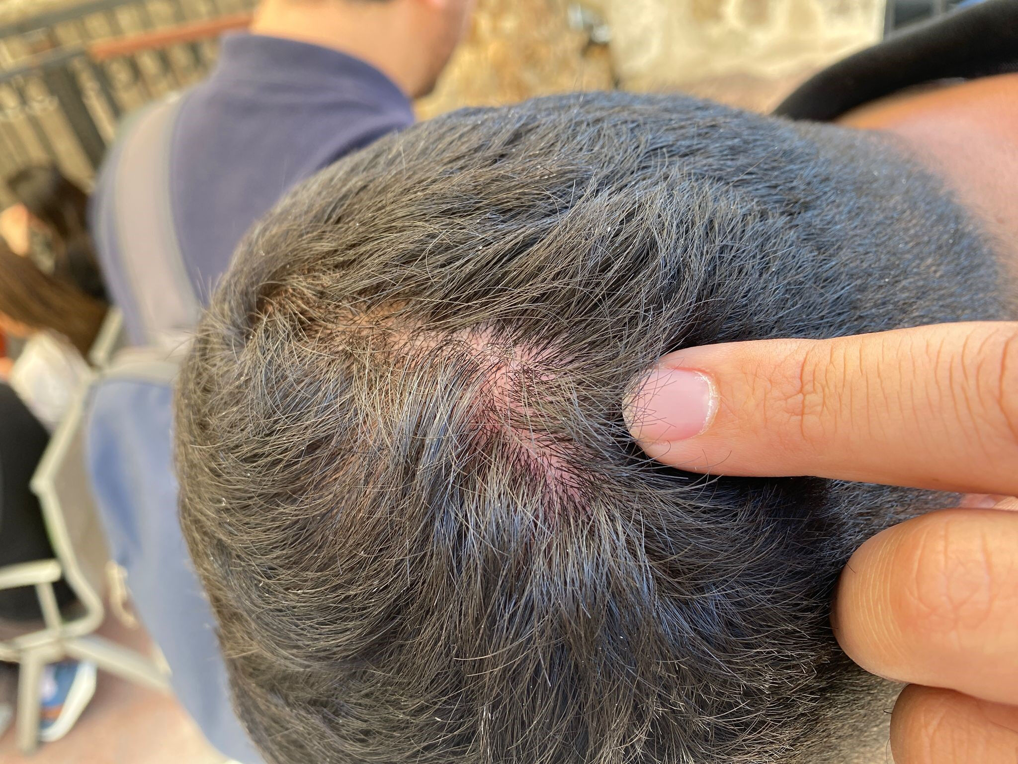 İzmir'de İHA ekibine çirkin saldırı! Özgür Özel'in boykot çağrısı can yaktı - 3. Resim