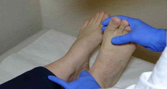 Mantar enfeksiyonunda onlara dikkat: Ciğerlere inebilir... - 4. Resim