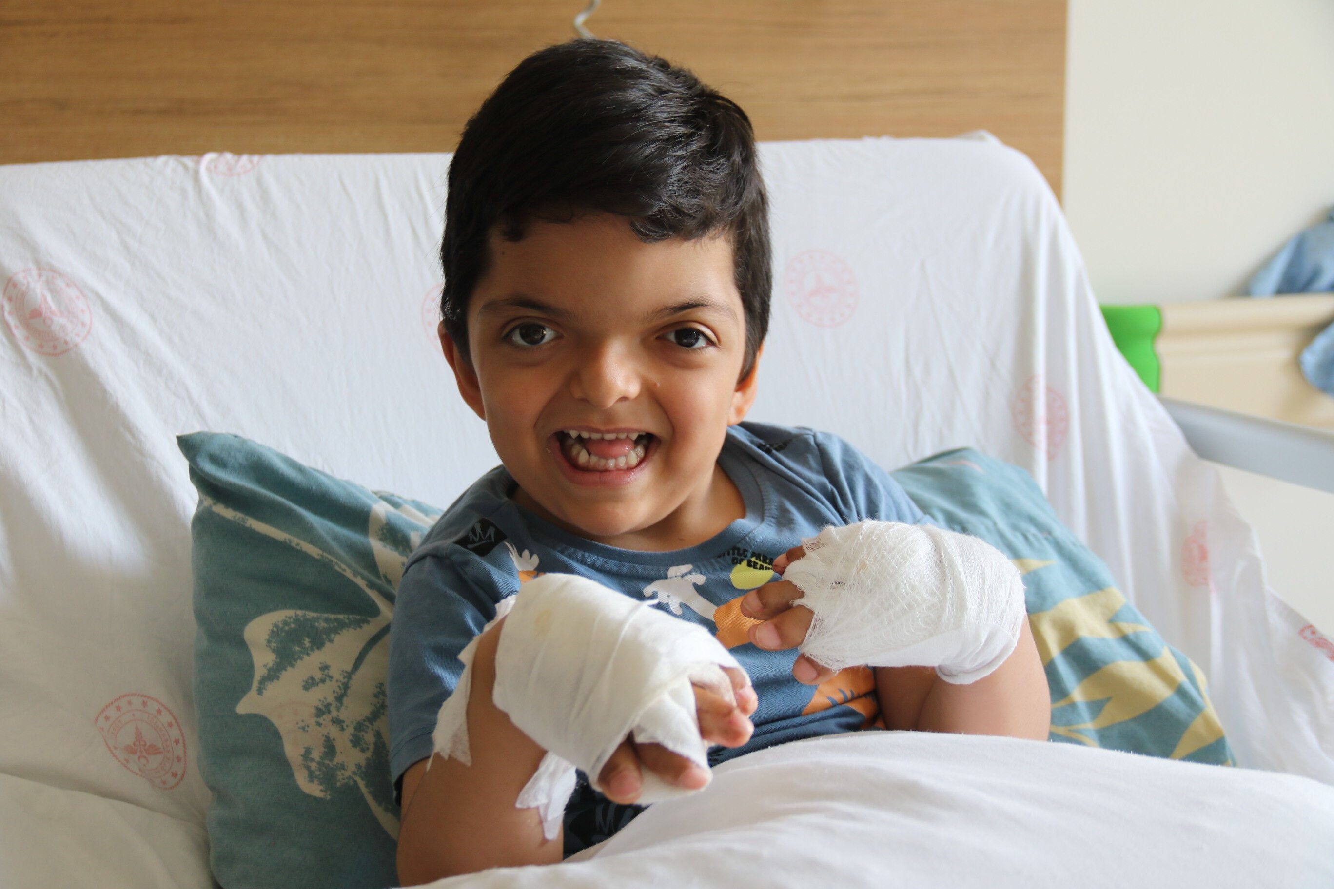 160 bin doğumda 1 görülüyor! Doktorlar bile şaşırdı: İsmini bilmiyorlar, 4 yaşındaki çocukta görüldü - 1. Resim