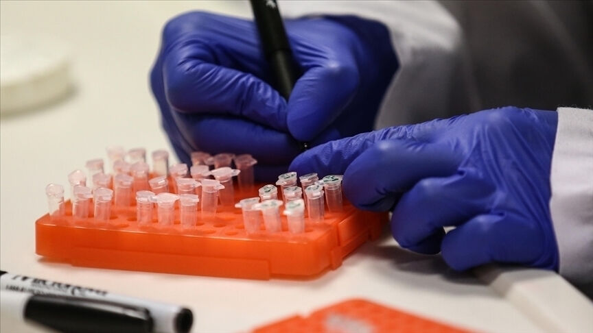 Sert semptomları var, insandan ve hayvandan geçiyor! Afrika'da 4 kişide daha görüldü - 2. Resim