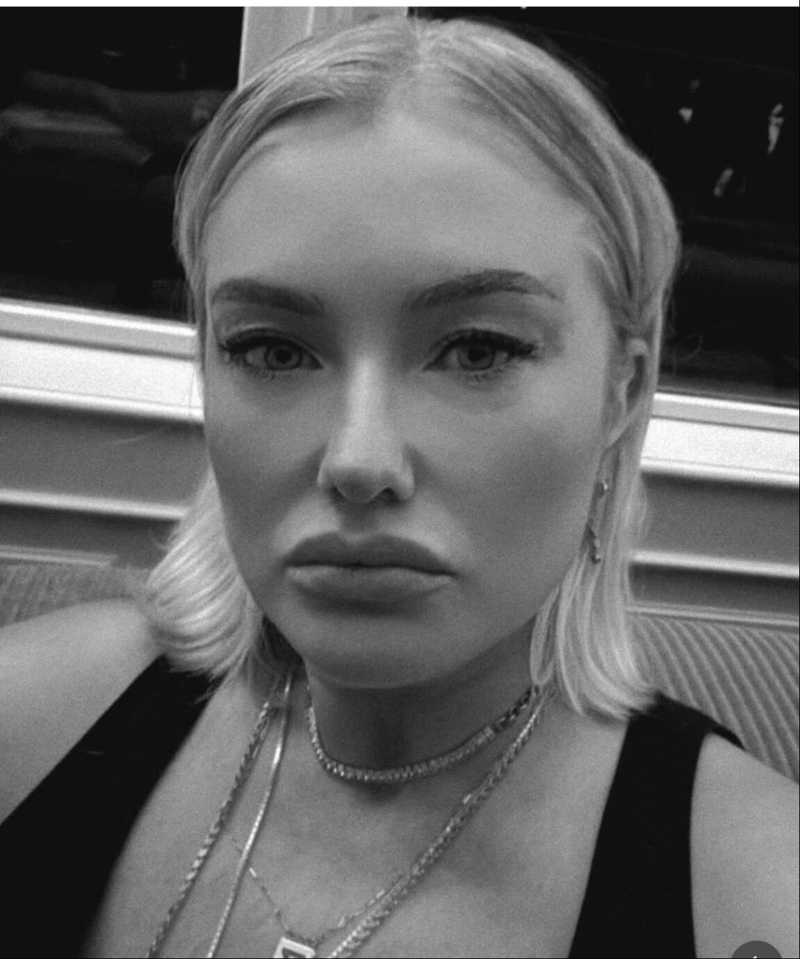 Sırra kadem basan Hilal Cebeci'nin son hali olay oldu! Görenler 'Bu kim?' dedi - 2. Resim