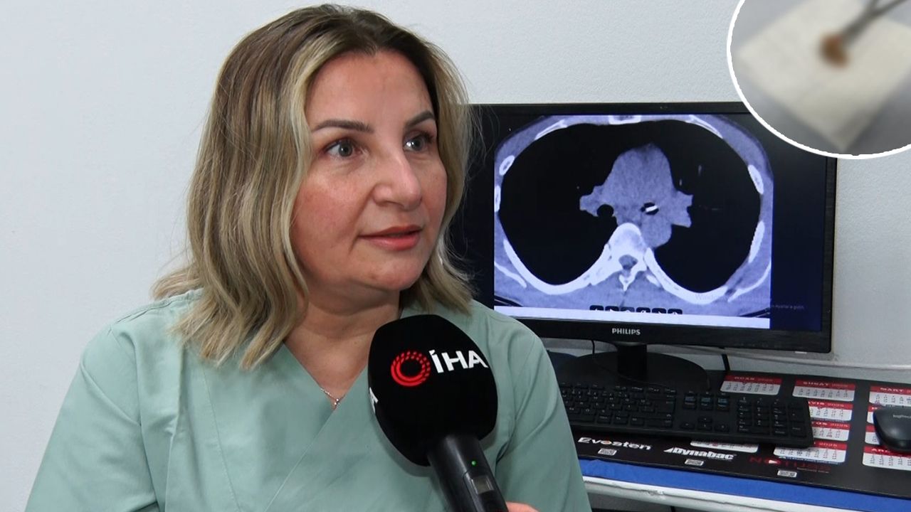 Sabah öksürükle uyandı, aynaya baktığında hayatının şokunu yaşadı! Sabah öksürükle uyandı, aynaya baktığında hayatının şokunu yaşadı!