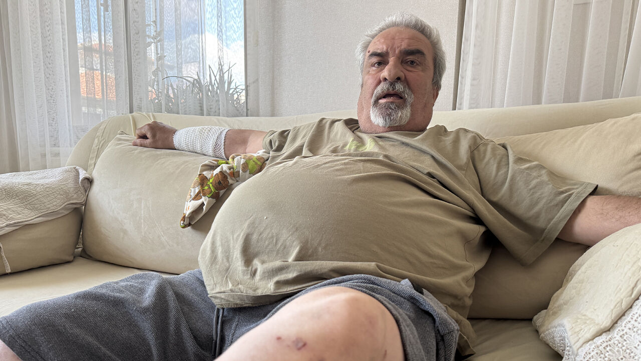 Yaşlı adama 4 köpek birden saldırdı! Elini ayağını parçaladılar, 76 dikiş atıldı - 1. Resim