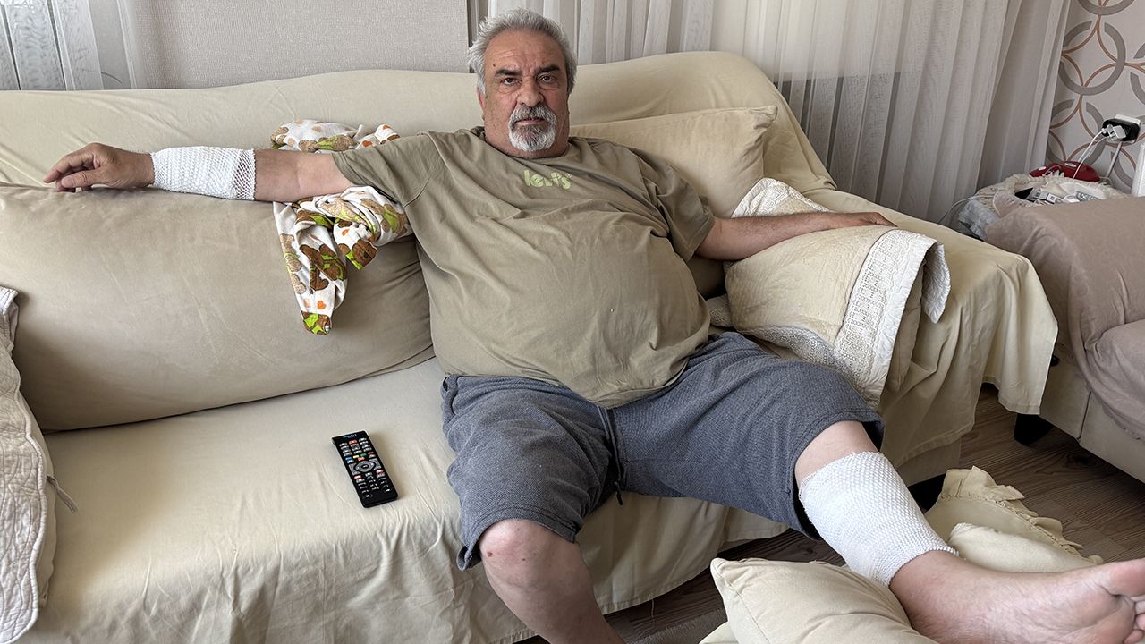 Yaşlı adama 4 köpek birden saldırdı! Elini ayağını parçaladılar, 76 dikiş atıldı Yaşlı adama 4 köpek birden saldırdı! Elini ayağını parçaladılar, 76 dikiş atıldı