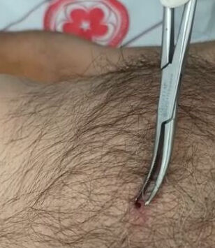 Bu belirtilere dikkat! İyice takip edin, KKKA virüsü taşıyor olabilirsiniz - 1. Resim