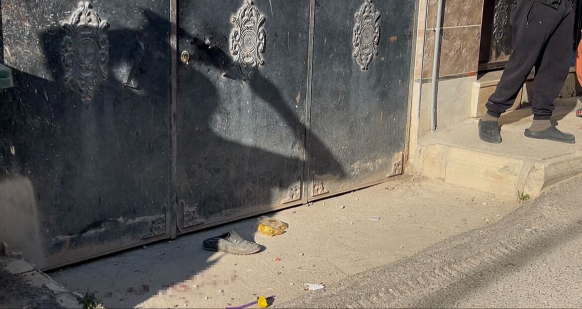 Palalı saldırgan dehşet saçtı! Babayı ve oğlunu hastanelik etti... O anlar kameraya yansıdı - 3. Resim