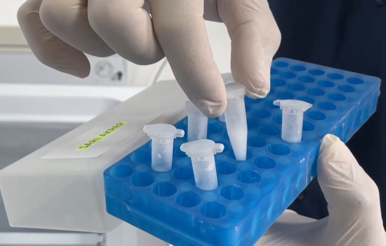 450 tanesinden ayda 1 gram çıkıyor! Aklına bile gelmezdi, üç ayda tamamladı - 3. Resim