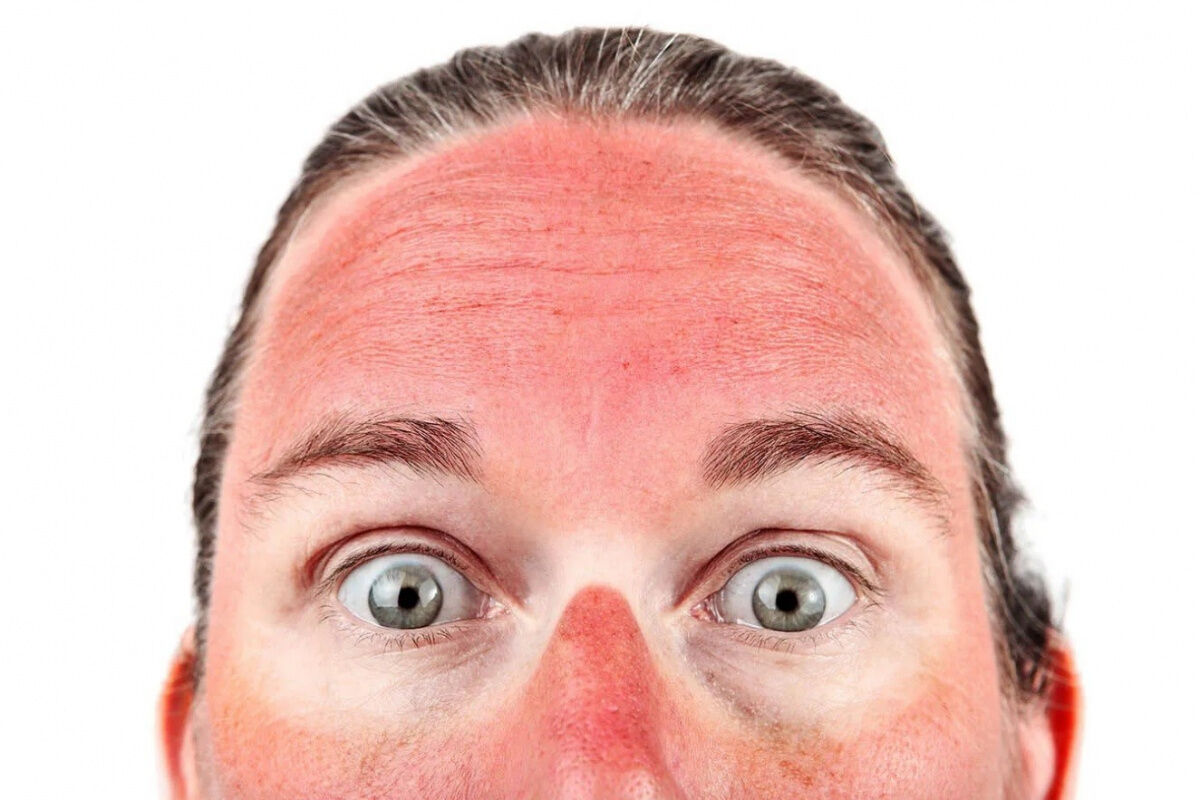 Cildiniz yaza hazır mı? İşte uzmanından sağlıklı bir cilt i&ccedil;in altın &ouml;neriler... - 4. Resim