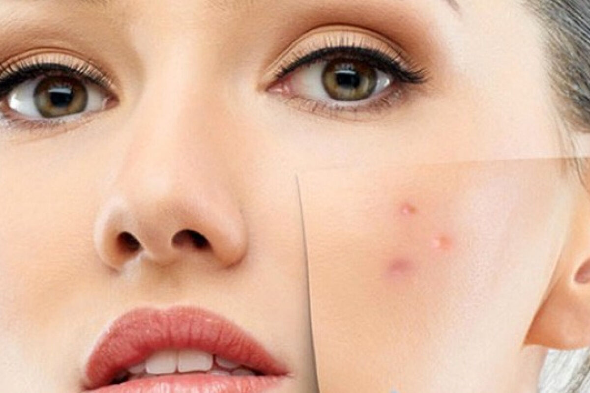 Cildiniz yaza hazır mı? İşte uzmanından sağlıklı bir cilt i&ccedil;in altın &ouml;neriler... - 6. Resim