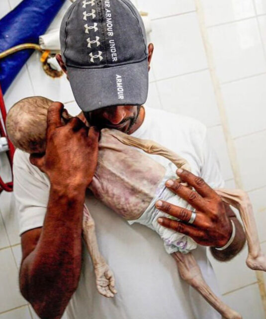 Gazze'de açlıktan ölen çocuk sayısı artıyor! 29 çocuk can verdi, 6'sı ölümün eşiğinde - 1. Resim