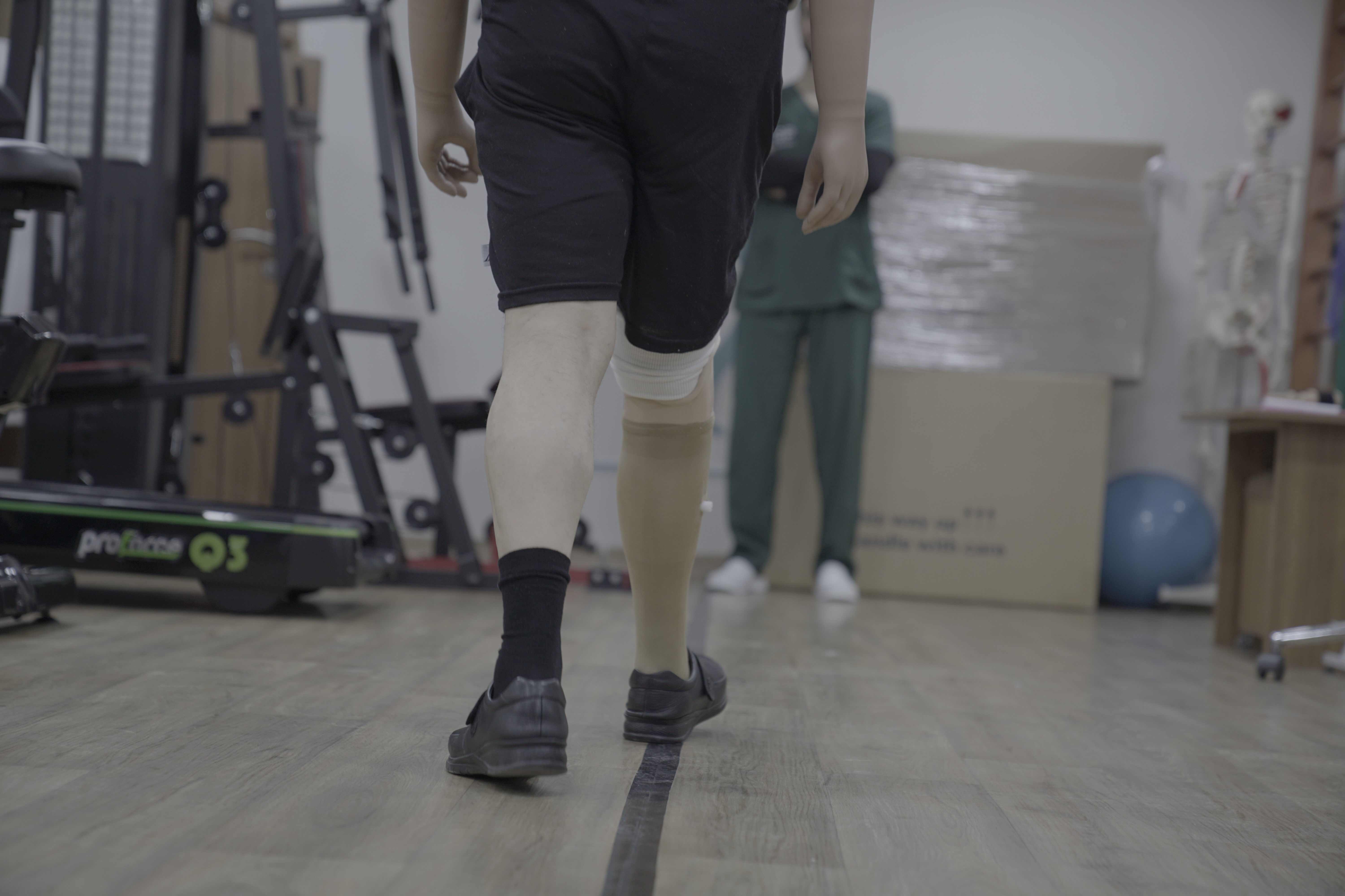 Üç uzvunu kaybetti, protezlerle hayata tutundu - 1. Resim