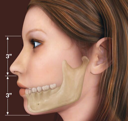 Bu ilaçlar korkulu rüyaya dönüşüyor... Uzmanlar uyardı: Çeneyi çökertiyor, dişleri bozuyor! - 3. Resim