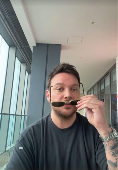 Yüzündeki değişim çok konuşulmuştu! Sinan Akçıl'dan estetik iddialarına cevap - 3. Resim