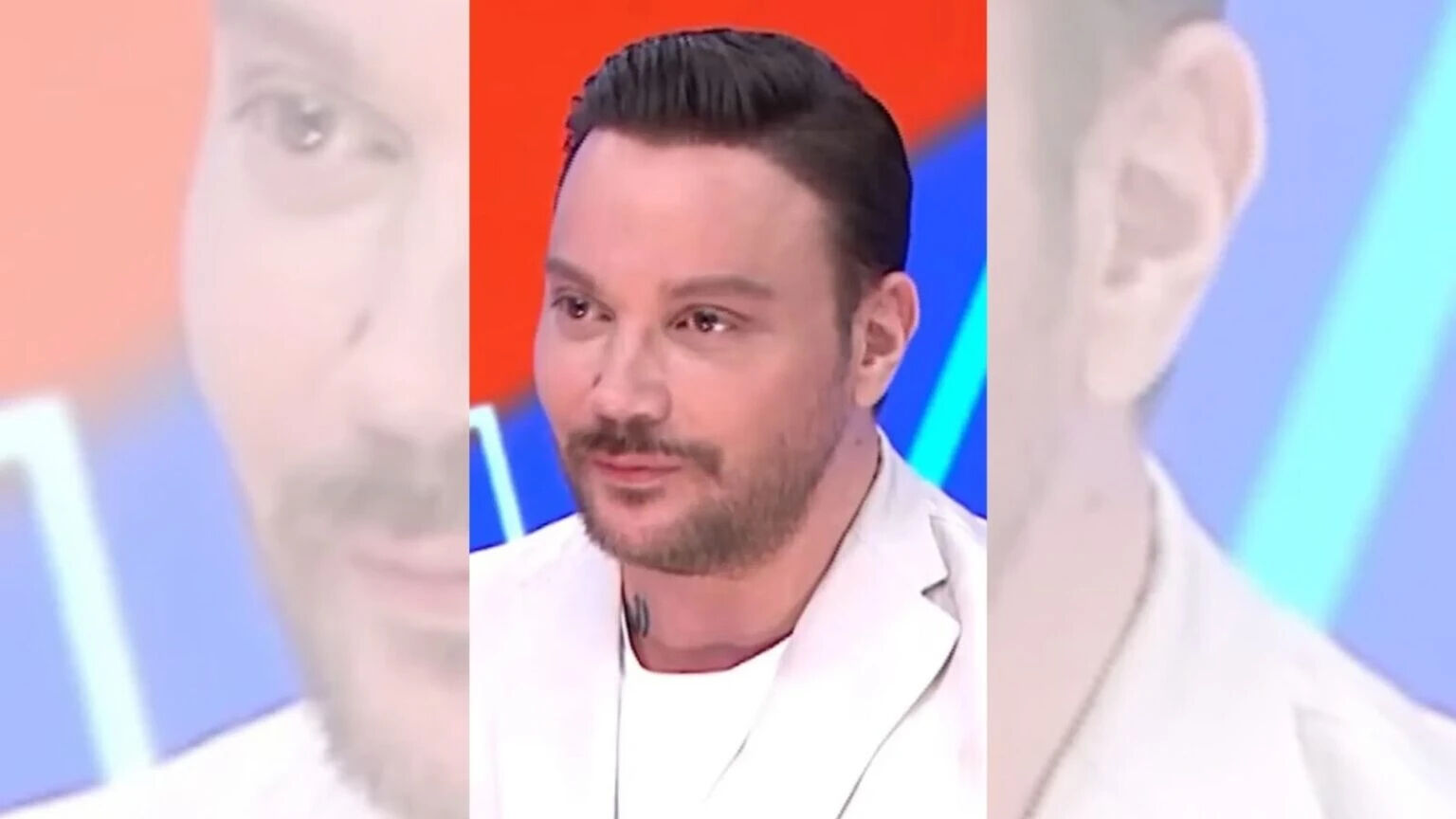 Yüzündeki değişim çok konuşulmuştu! Sinan Akçıl'dan estetik iddialarına cevap - 2. Resim