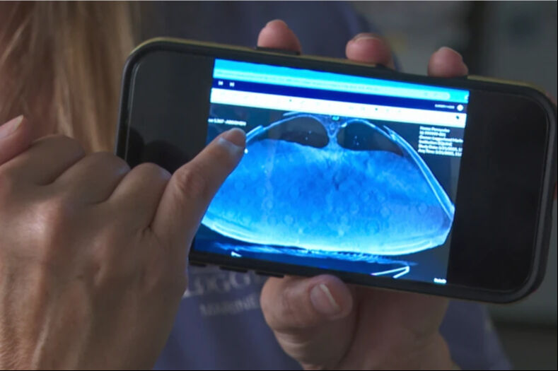 Teknenin çarptığı caretta caretta tedavi altına alınmıştı! Hastanede korku ve sevinç bir arada yaşandı - 2. Resim