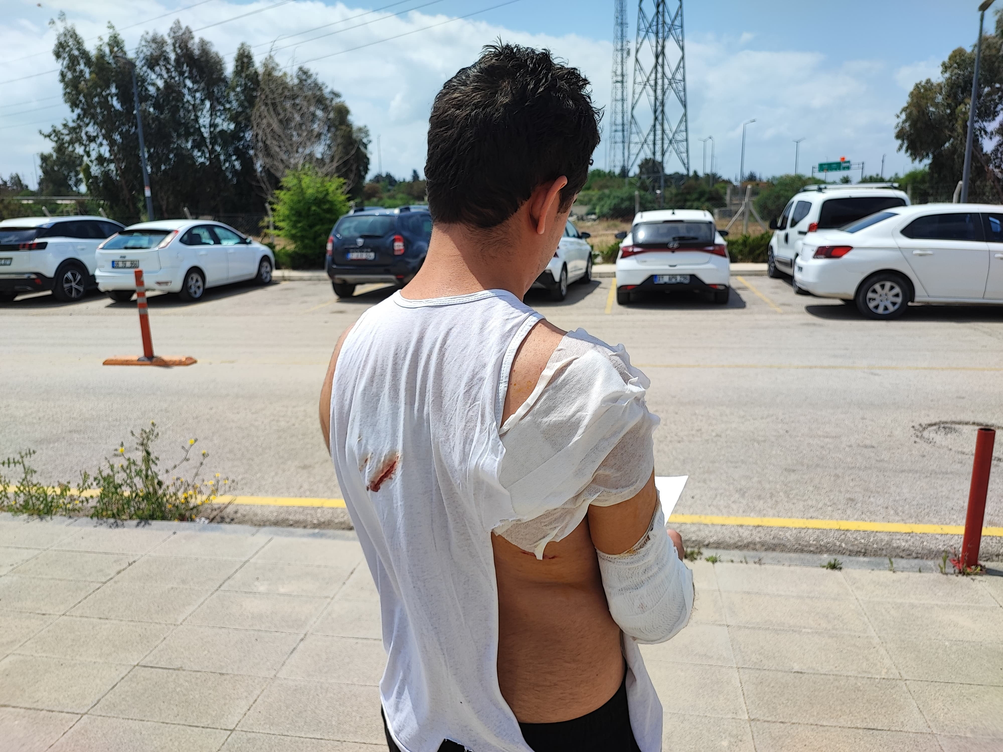 Adana’da sahipsiz köpek dehşeti! 24 yaşındaki genç kabusu yaşadı - 3. Resim