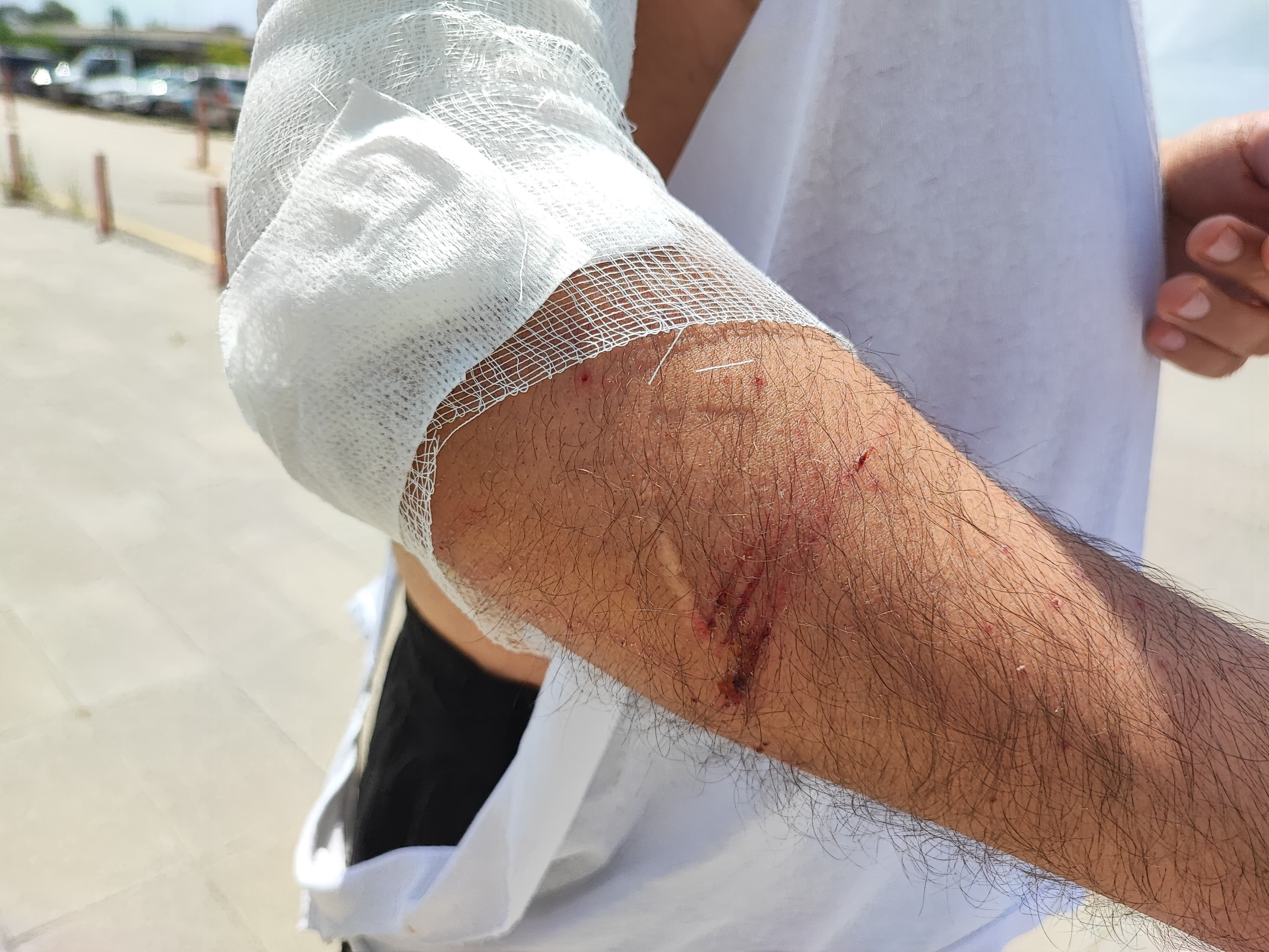 Adana’da sahipsiz köpek dehşeti! 24 yaşındaki genç kabusu yaşadı - 2. Resim