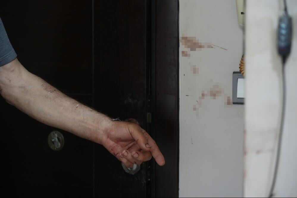 Sosyal medyada tanıştığı kadın hayatını kararttı! Barışma teklifine kandı, canını komşuları kurtardı - 1. Resim