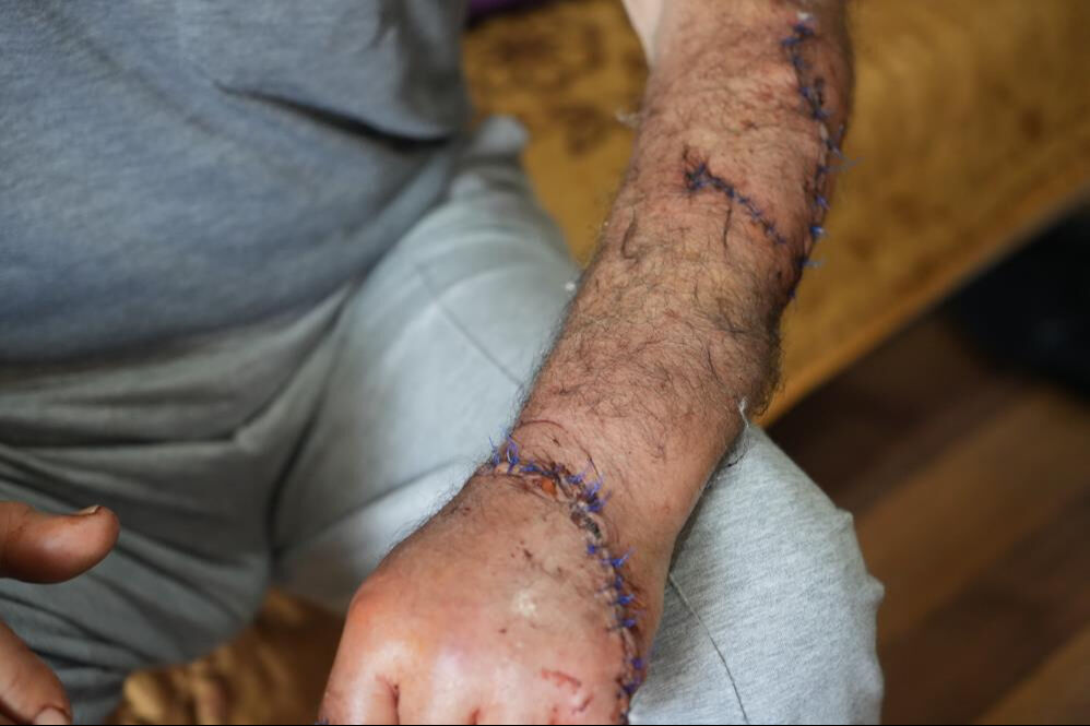 Sosyal medyada tanıştığı kadın hayatını kararttı! Barışma teklifine kandı, canını komşuları kurtardı - 10. Resim