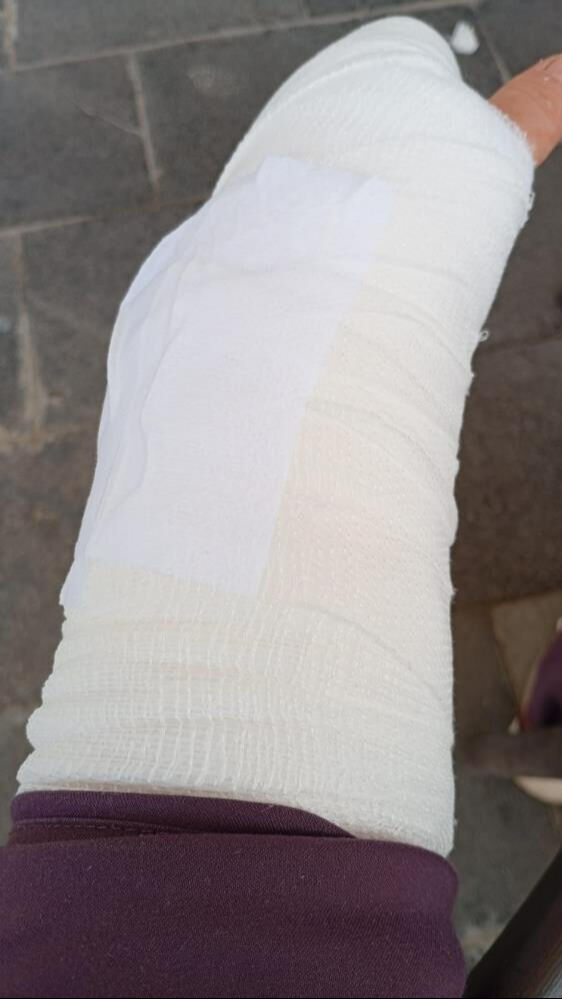 Antalya'da işe giden kadına çarpıp kaçtı! Plakası ve tamponu olay yerinde delil olarak kaldı İşe giden kadına çarpıp kaçtı! Plakası ve tamponu olay yerinde delil olarak kaldı - 4. Resim