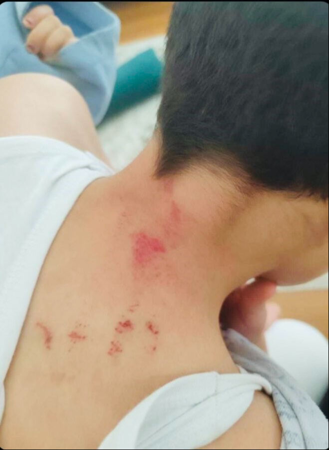 Sınıfta dayak skandalı! &Ouml;ğretmen 10 yaşındaki &ccedil;ocuğu hastanelik etti - 1. Resim