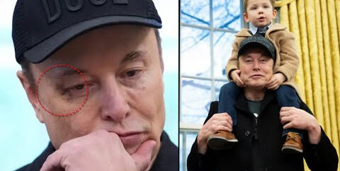 Elon Musk’ın gözüne ne oldu? Beyaz Saray çalkalanıyor - 1. Resim