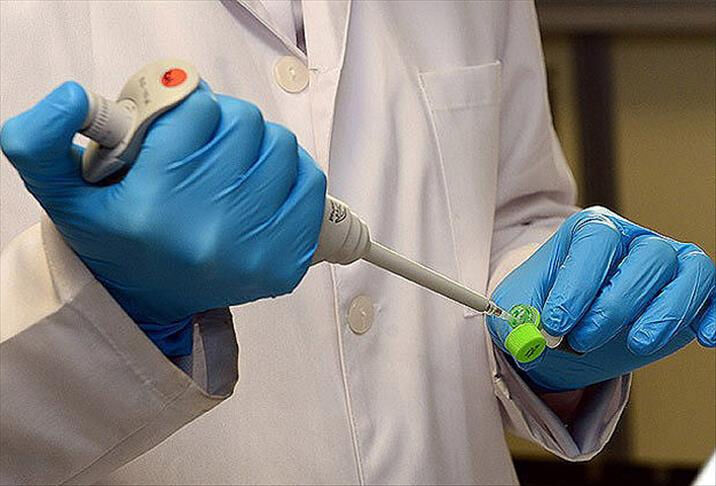 O virüs can aldı! Afrika ülkesinde alarma geçildi: Enfekte olanlar var - 3. Resim