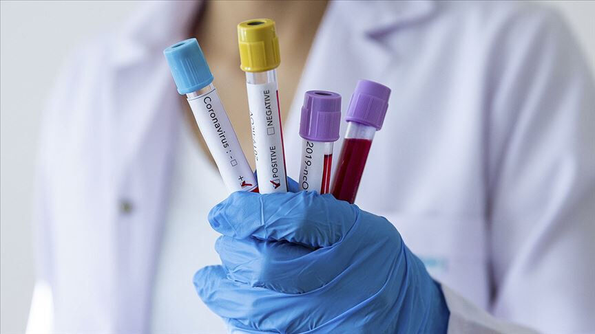 O virüs can aldı! Afrika ülkesinde alarma geçildi: Enfekte olanlar var - 2. Resim