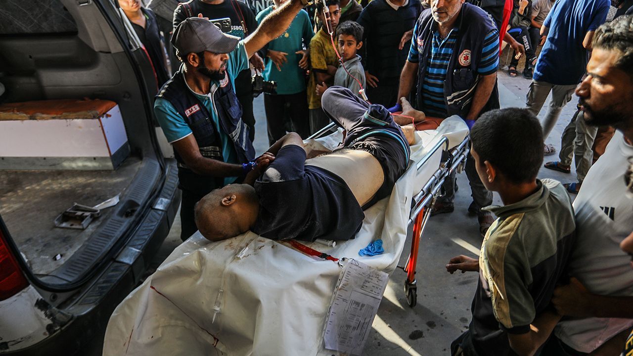 İsrail'den Gazze'de insani yardım almaya çalışan Filistinlilere hain saldırı! En az 30 ölü, 115 yaralı İsrail'den Gazze'de insani yardım almaya çalışan Filistinlilere hain saldırı! En az 30 ölü, 115 yaralı