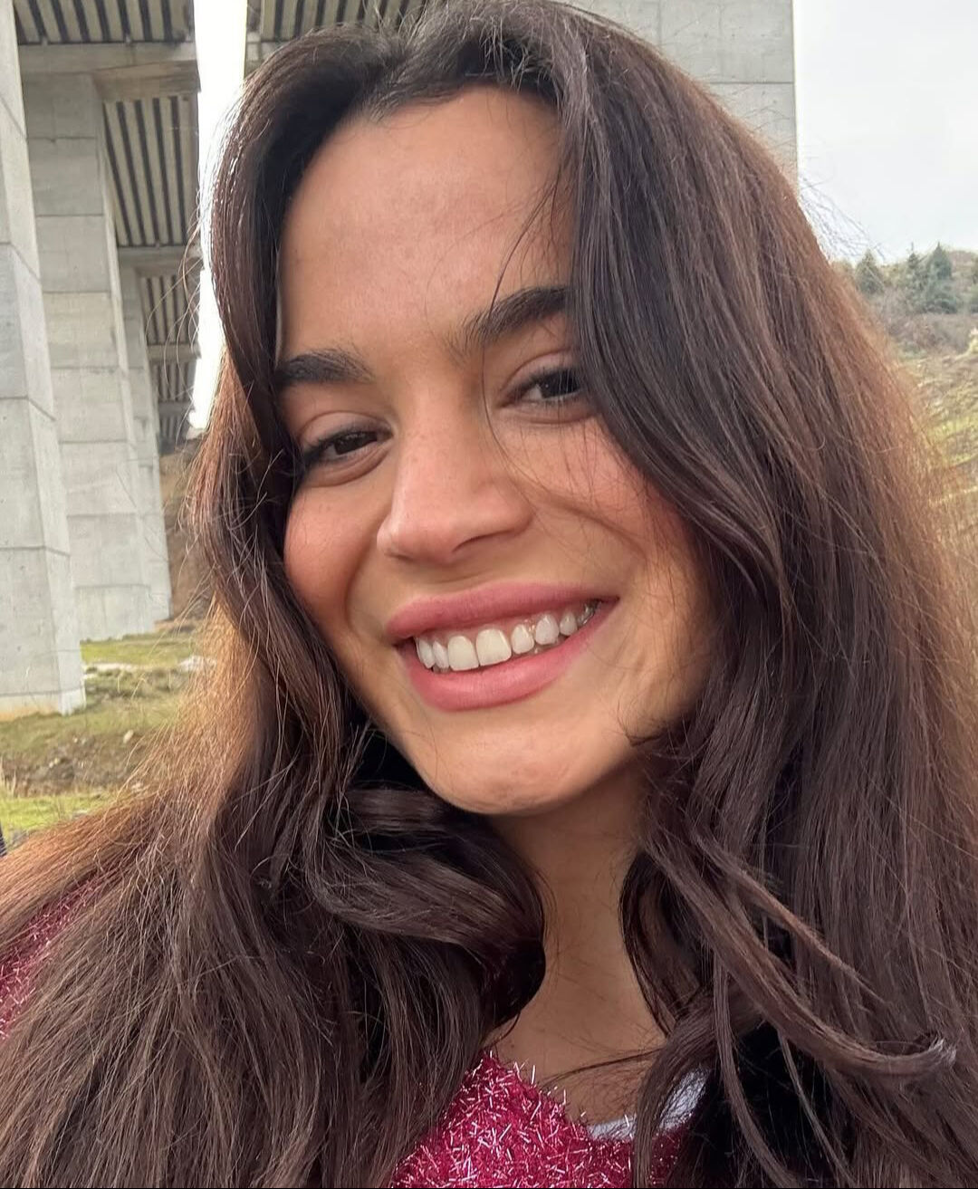 Aslı Bekiroğlu'nun ameliyatı 9 saat sürdü! Ünlü oyuncunun sağlık durumu - 1. Resim
