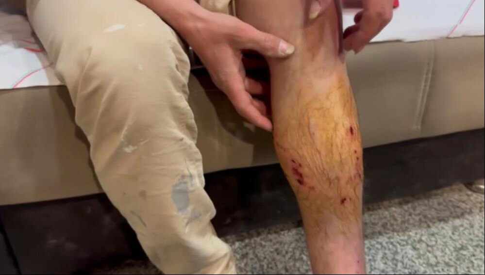 Yolda y&uuml;r&uuml;yen adama Bel&ccedil;ika Kurdu saldırdı! - 4. Resim