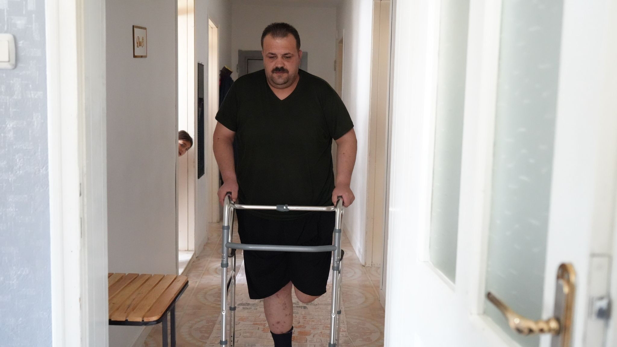 Tedavi için gitti, ayağı kesildi! Terapi yapılacaktı, soluğu savcılıkta aldı - 2. Resim