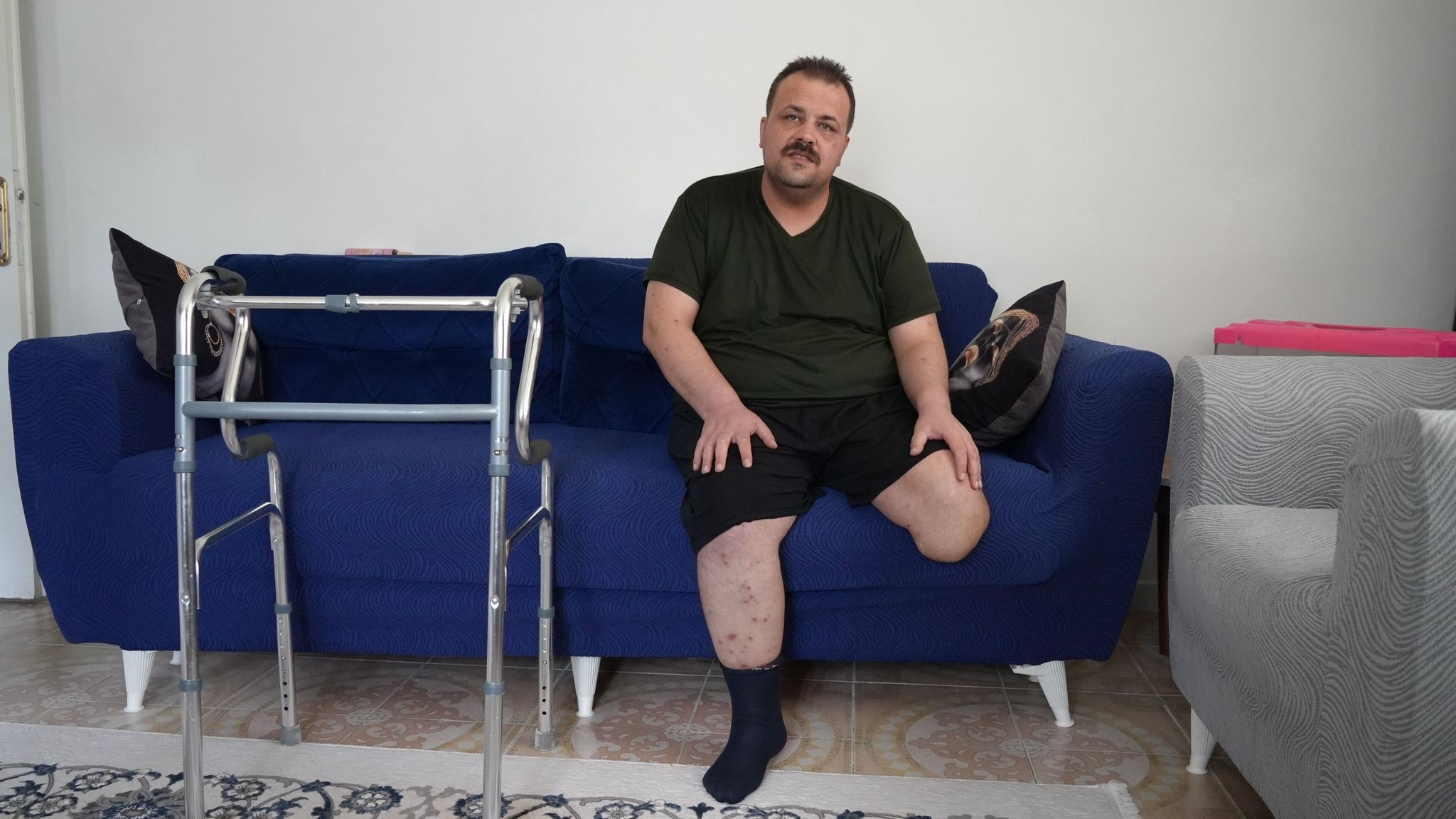 Tedavi için gitti, ayağı kesildi! Terapi yapılacaktı, soluğu savcılıkta aldı - 1. Resim