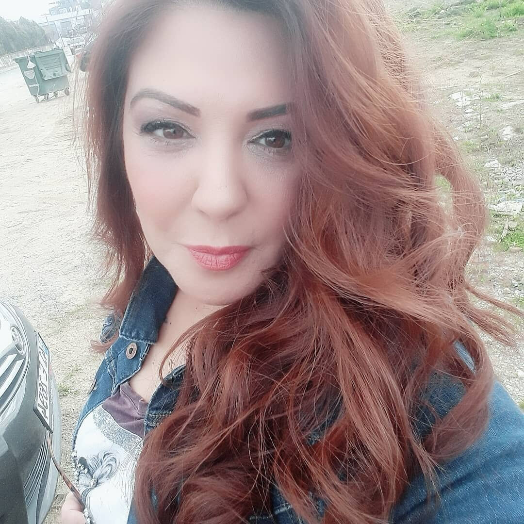 Estetik yaptıran oyuncu Eylem Tanrıver felç kaldı! Mesleğine devam edemiyor: Hayatımdan çalındı Estetik yaptıran oyuncu Eylem Tanrıver felç kaldı! Mesleğine devam edemiyor: Hayatımdan çalındı - 3. Resim